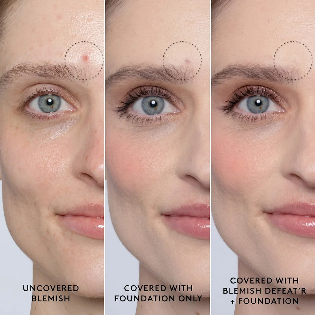Gel Skin Defeat'r Blemish BHA Fenty Spot-Targeting