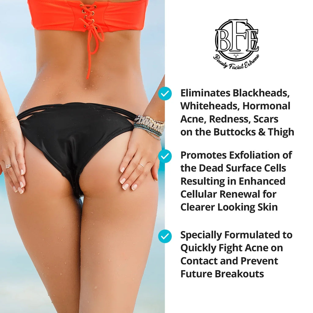 for and Prevents Breakouts. Future Acne, Buttocks Thigh Thigh Area. Anti-Acne Buttocks Away OZ Treatment- Pimples, and Ingrown & 6.9 Clears the Hairs