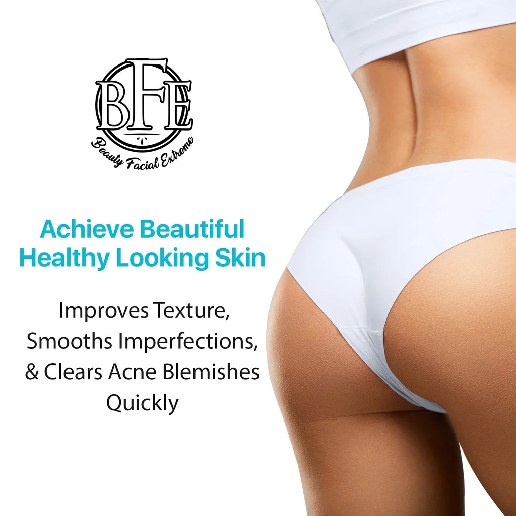 for and Prevents Breakouts. Future Acne, Buttocks Thigh Thigh Area. Anti-Acne Buttocks Away OZ Treatment- Pimples, and Ingrown & 6.9 Clears the Hairs
