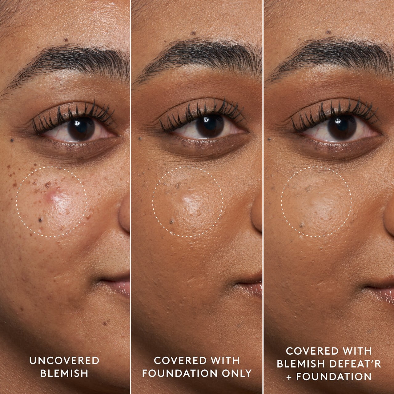 Gel Skin Defeat'r Blemish BHA Fenty Spot-Targeting